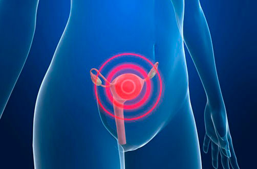 cancercervical.jpg